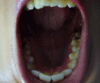 파일:60224.gif